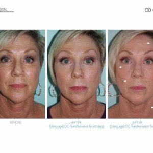 Ageloc Galvanic Spa met Facial Gels - Afbeelding 6
